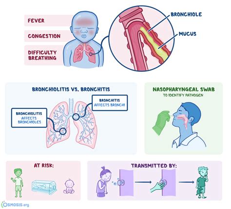 What Causes Respiratory Bronchiolitis